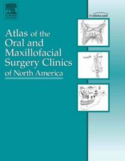 Cover of: Implant Procedures, An Issue of Atlas of the Oral and Maxillofacial Surgery Clinics