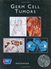 Cover of: Germ cell tumors