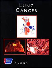 Cover of: Lung cancer
