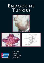 Cover of: Endocrine tumors by Orlo H. Clark ... [et al.].