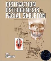 Distraction osteogenesis of the facial skeleton by William H. Bell, Cesar A. Guerrero