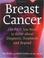 Cover of: Breast cancer