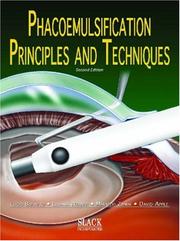 Cover of: Phacoemulsification: Principles and Techniques