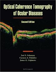 Cover of: Optical Coherence Tomography of Ocular Diseases