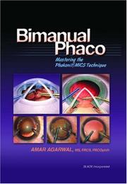 Cover of: Bimanual Phaco: Mastering the Phakonit/MICS Technique