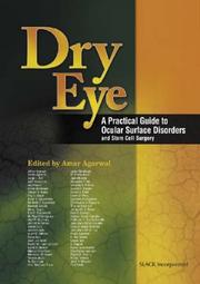 Cover of: Dry Eye: A Practical Guide to Ocular Surface Disorders and Stem Cell Surgery