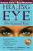 Cover of: Healing the Eye the Natural Way