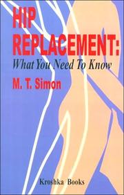 Cover of: Hip Replacement: What You Need to Know