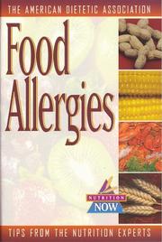Cover of: Food allergies