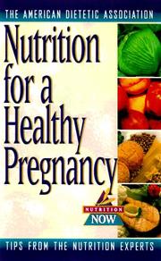 Cover of: Pregnancy nutrition by Elizabeth M. Ward