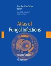 Cover of: Atlas of Fungal Infection