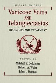 Cover of: Varicose veins and telangiectasias by edited by Mitchel P. Goldman, Robert A. Weiss, John J. Bergan.