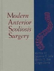 Cover of: Modern Anterior Scoliosis Surgery by 