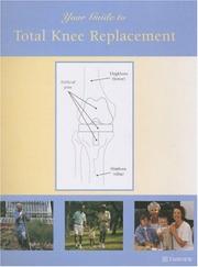 Cover of: Your Guide to Total Knee Replacement
