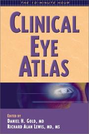 Cover of: Clinical eye atlas by edited by Daniel H. Gold, Richard Alan Lewis.