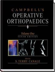 Cover of: Campbell's operative orthopaedics by edited by S. Terry Canale ; editorial assistance by Kay Daugherty and Linda Jones ; art coordination by Barry Burns.