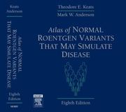 Cover of: Atlas of Normal Roentgen Variants That May Simulate Disease