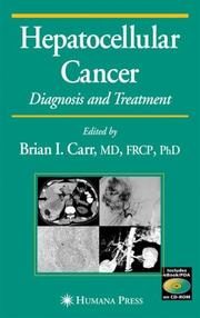 Cover of: Hepatocellular Cancer: Diagnosis and Treatment (Current Clinical Oncology)
