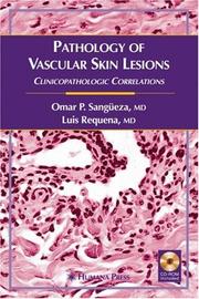 Pathology of vascular skin lesions