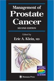 Cover of: Management of Prostate Cancer (Current Clinical Urology) by Eric A. Klein, Eric A. Klein