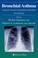 Cover of: Bronchial Asthma