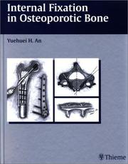 Cover of: Internal Fixation In Osteoporotic Bone
