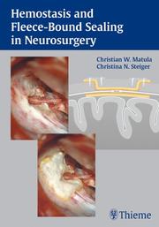 Hemostasis and fleece-bound sealing in neurosurgery by Christian W., M.D. Matula, Christina N., M.D. Steiger, Marion Reddy