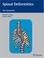 Cover of: Spinal Deformities