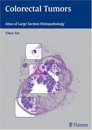 Cover of: Colorectal Tumors by Tibor Tot