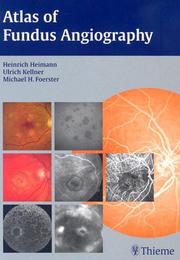 Cover of: Atlas of Fundus Angiography