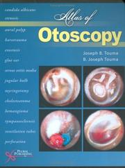 Atlas of otoscopy by Joseph B., Ph.D. Touma, B. Joseph, M.D. Touma