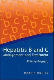 Cover of: Hepatitis B and C: Management and Treatment
