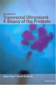 Cover of: Handbook of Transrectal Ultrasound and Biopsy of the Prostate