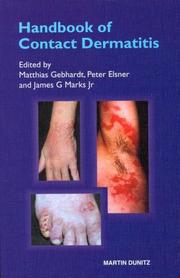 Cover of: Handbook of Contact Dermatitis