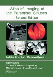 Cover of: Atlas of Imaging of the Paranasal Sinuses, Second Edition