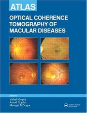 Cover of: Atlas of Optical Coherence Tomography of Macular Diseases