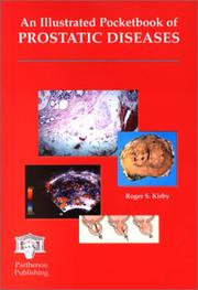 Cover of: An illustrated pocketbook of prostatic diseases