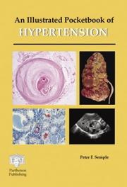 Cover of: An illustrated pocketbook of hypertension
