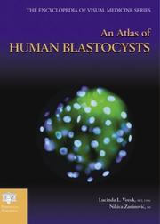 Cover of: An atlas of human blastocysts by [edited by] Lucinda L. Veeck and Nikica Zaninovic.