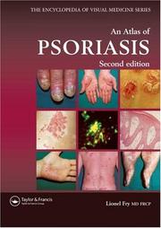 Cover of: An Atlas of Psoriasis, Second Edition (Encyclopedia of Visual Medicine)