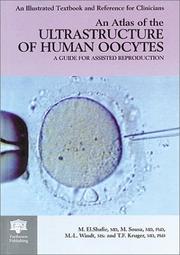 Cover of: An atlas of the ultrastructure of human oocytes by M. El Shafie, Mario Sousa, Thunus F. Kruger