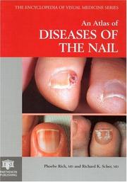 Cover of: An atlas of diseases of the nail by Phoebe Rich