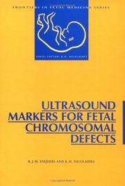 Ultrasound markers for fetal chromosomal defects by R. J. M. Snijders