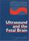 Cover of: Ultrasound and the fetal brain