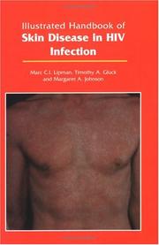 Cover of: Illustrated handbook of skin disease in HIV infection