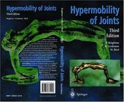 Cover of: Hypermobility of joints by Peter Beighton