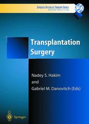 Cover of: Transplantation Surgery (Springer Specialist Surgery Series)