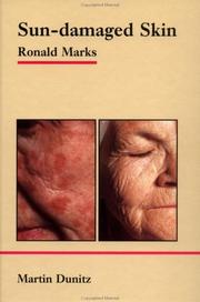 Cover of: Sun-Damaged Skin