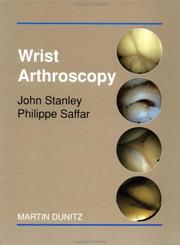 Cover of: Wrist Arthroscopy