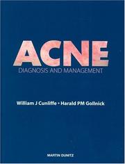 Cover of: Acne by W. J. Cunliffe, Harold P.M. Gollnick